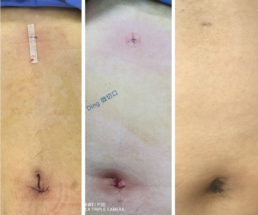 Clinical Case 4